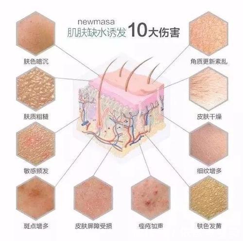 角质层|新依美美肤:为什么肌肤要补水?你属于哪种程度缺水?