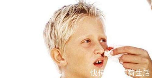压迫止血法|宝宝容易流鼻血，父母不要再用纸巾塞鼻孔了，用其它的方法止血