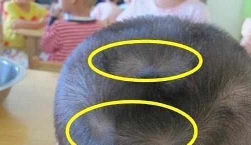 父母|为什么有的孩子头上有“2个旋”代表什么意思,父母要知道!