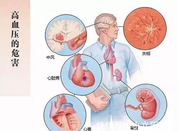 医生|每天吃鸡蛋对“血压”好不好？医生：不止鸡蛋，这3种食物也少吃