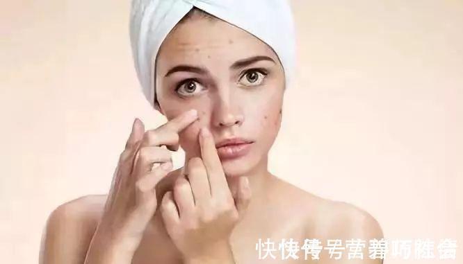 清洁|长痘成女生“心病”，怎样预防长痘？长痘要注意什么？
