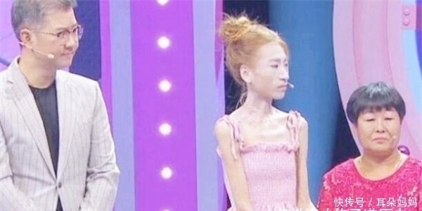 现在就告白|当年从120减到58斤,为爱变成“骷髅妹”的刘野,如今过得怎样?