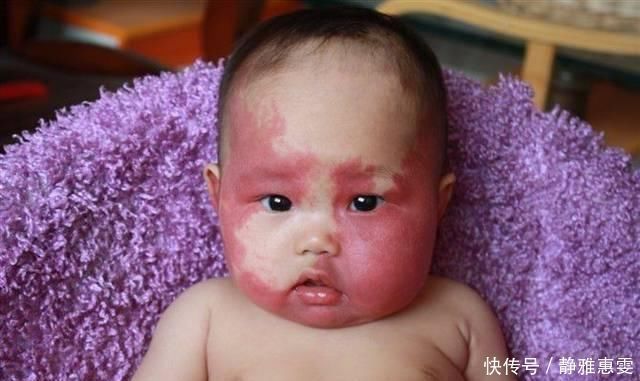 胎记|胎记代表上辈子去世的方式网友大开脑洞那这个死法还真特别