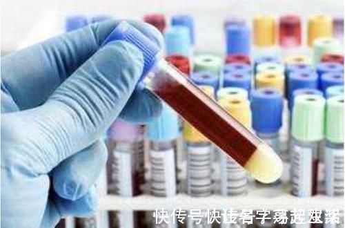 糖尿病人|糖尿病要是不想一辈子吃药,那就多吃“它”,帮你告别胰岛素