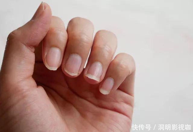 女人气血虚，皮肤差老得快！1个方法能让气血补遍全身，绽放年轻