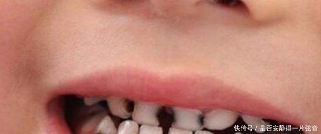 冷饮|从小爱吃冷饮的孩子，和不爱吃冷饮的孩子，长大后的差距一目了然