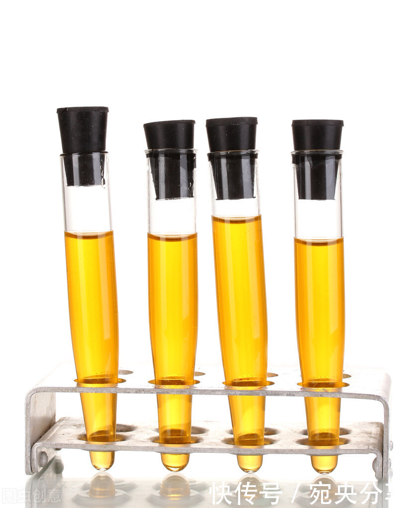 宛央法国：“黄金贵族”玻色因究竟有没有被神化？