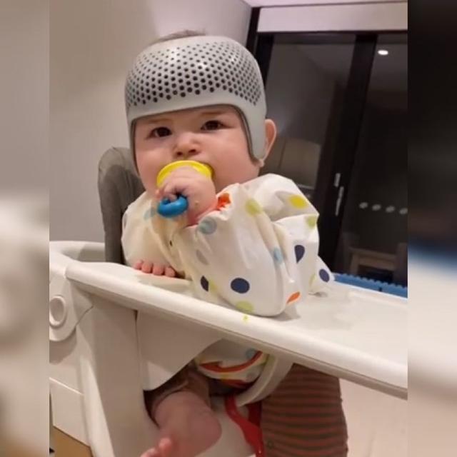 父母|宝宝头睡扁了,没想到戴上头盔却是这样的反应,网友看着都心疼