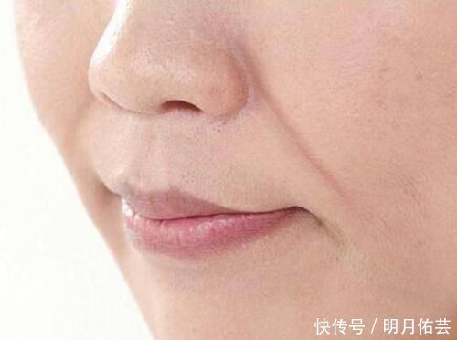 项目|我想祛除法令纹,医美的诸多项目,该如何选择?