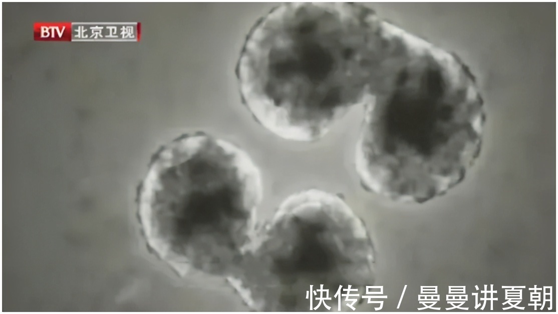 急性|这些炎症可能比癌症更可怕,发病快、致死率高