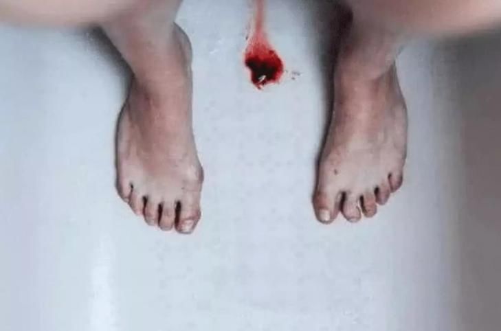 女生|女生月经期，为什么会排出像“肉”一样的血块？女网友：影响怀孕吗？