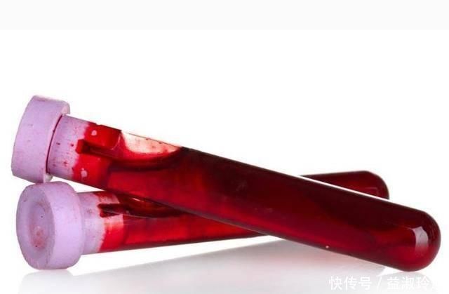 血型是这种的女人,头胎尽量别流掉,第一个宝宝很重要