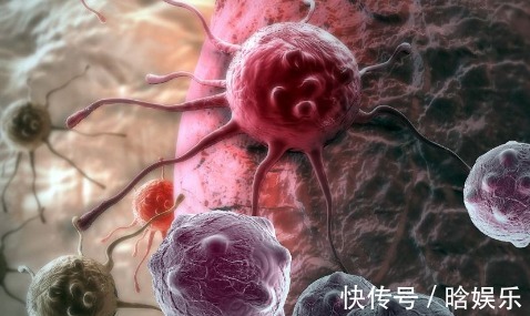 癌症复发|想要治愈癌症,首先要满足4个条件,可惜挺过去的人不多