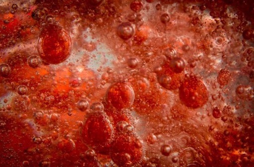 心脑血管|血脂越来越高,皮肤会出现4个变化,早点治疗,莫不放在心上