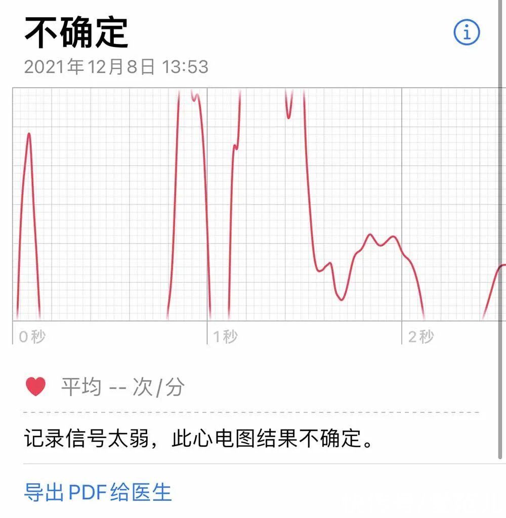 心电图|等了 3 年，国行版 Apple Watch 心电图功能终于来了