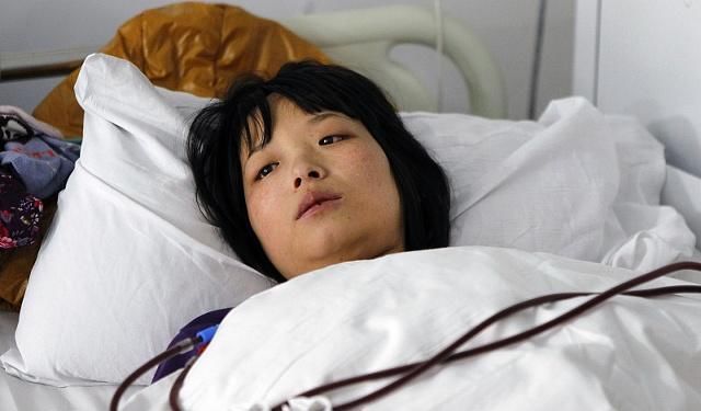 玩意|宫颈病变前，内裤上可能出现这“玩意”，若你没有，子宫还算不错