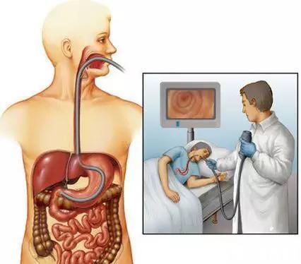为什么要做胃镜？胃镜有何神奇之处？|体检季 | 胃镜检查
