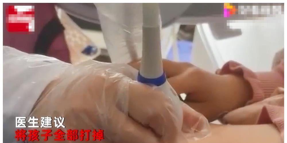 八胞胎|女子怀上“八胞胎”又惊又喜,自己表示想留4-5个,婆家却不同