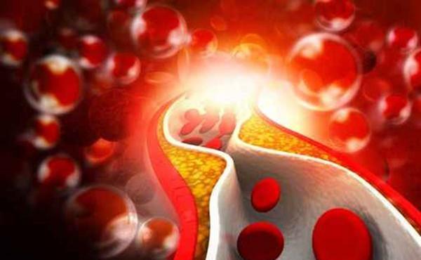 医生|每天担心胆固醇高?医生:是因为你不了解它,其实很好控制