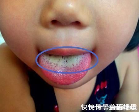 孩子|儿科医生提醒:这3种肉是“虐”娃真凶,最伤孩子脾胃,家长少买