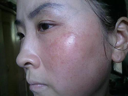 你知道干性皮肤该怎么保养吗?快进来做笔记