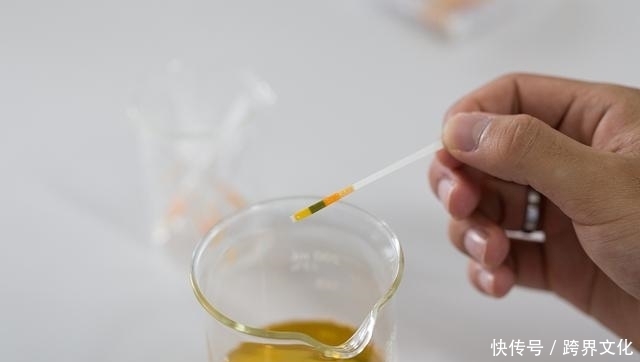 尿酸过高,上厕所时会出现3种表现,若占其中之一,最好检查肾脏