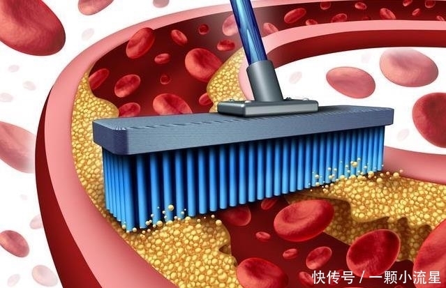 远离|年龄越大血管越堵,1种叶子常泡水喝,通血管,远离血栓困扰!