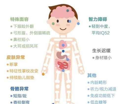 陈医生|孩子长得“太漂亮”像洋娃娃，医生：这是一种病！