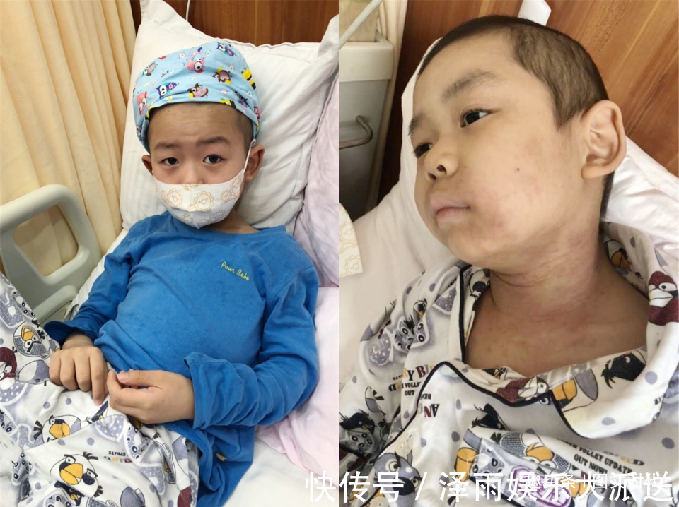 医生|2岁男童查出白血病,治疗三年后出院回家,复查时被医生留下