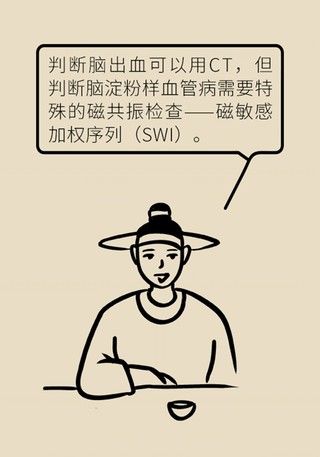 瞌睡|记性变差容易瞌睡，有可能是这种脑出血