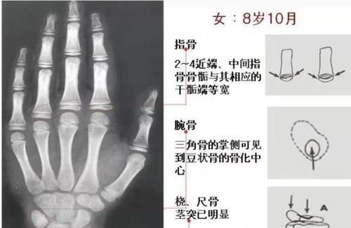 睡眠时间|孩子身高是否达标?来对照!孩子的另一个“年龄”,你注意到了吗?