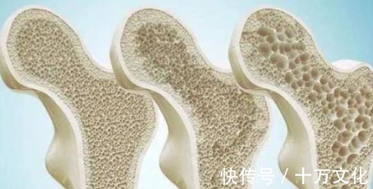 吸收率|吃虾皮可以补钙医生真正补钙的是这4种食物,很多人却不爱吃