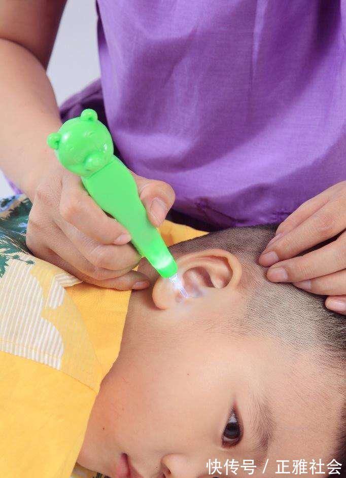 小冰|生下来从不掏耳朵的孩子:6年的耳屎变成“水泥柱子”,多久清理一次合适?