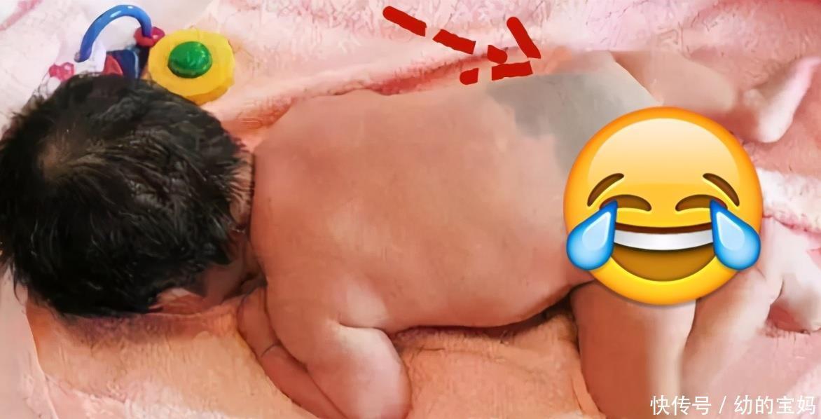 蒙古斑|“屁股青,淘人精”宝宝屁股“淤青”的秘密,你知道多少