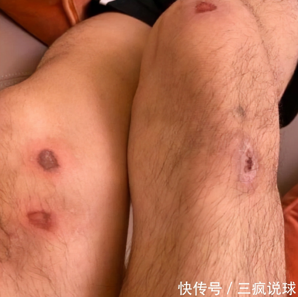 赛季|辽宁新赛季堪忧!郭艾伦突传坏消息,杨鸣争冠还没开始就遭重创