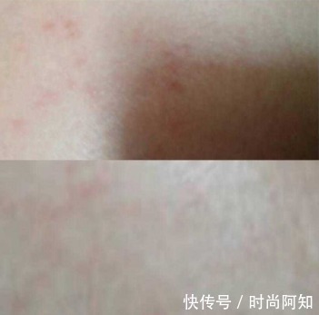 女人|女人会不会长妊娠纹,这3个细节早就有暗示,不用生完孩子才知道