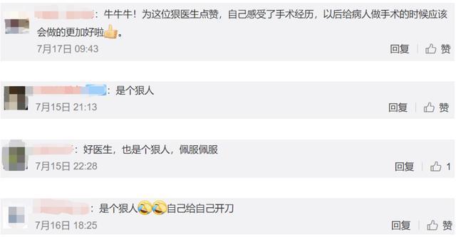 大拇指|医生患上“妈妈手”,竟自己给自己做手术,网友是个狠人,佩服