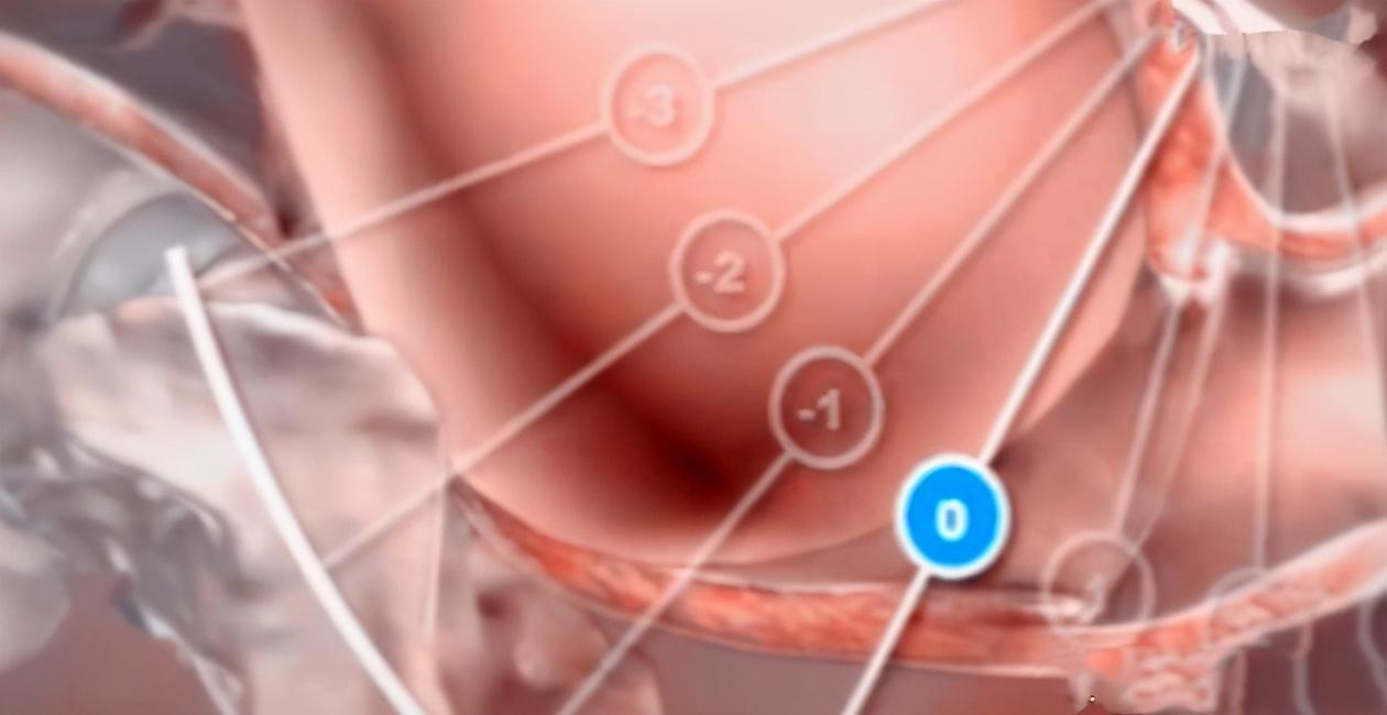 yoyo|为什么顺产会很痛4张图讲解原因，妈妈没有容易的