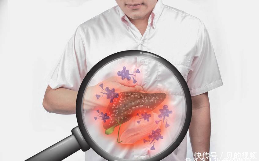 肺癌|它跟肺癌、肝癌关系密切,而你却天天在食用