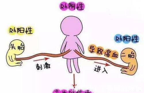 黄疸|听说过“八字不合”,但夫妻“血型不合”才最危险,孕前需检查