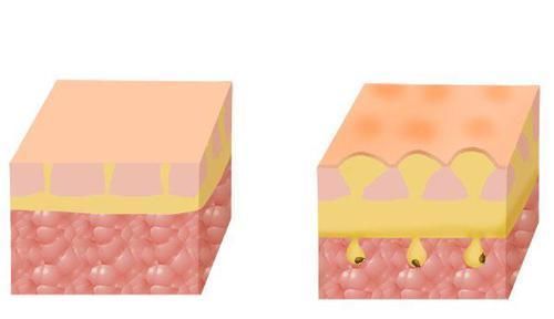 鼻子上总能挤出很多白点,到底是什么送你妙招,鼻子变干净