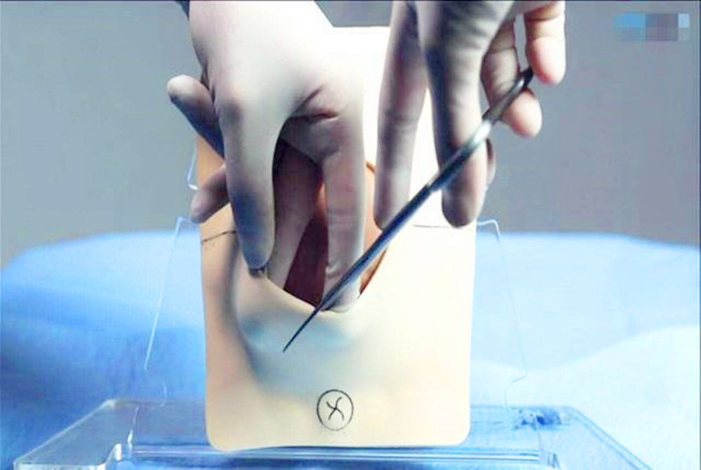 生完2胎想永久避孕,上环到底好不好该怎么选女性须知