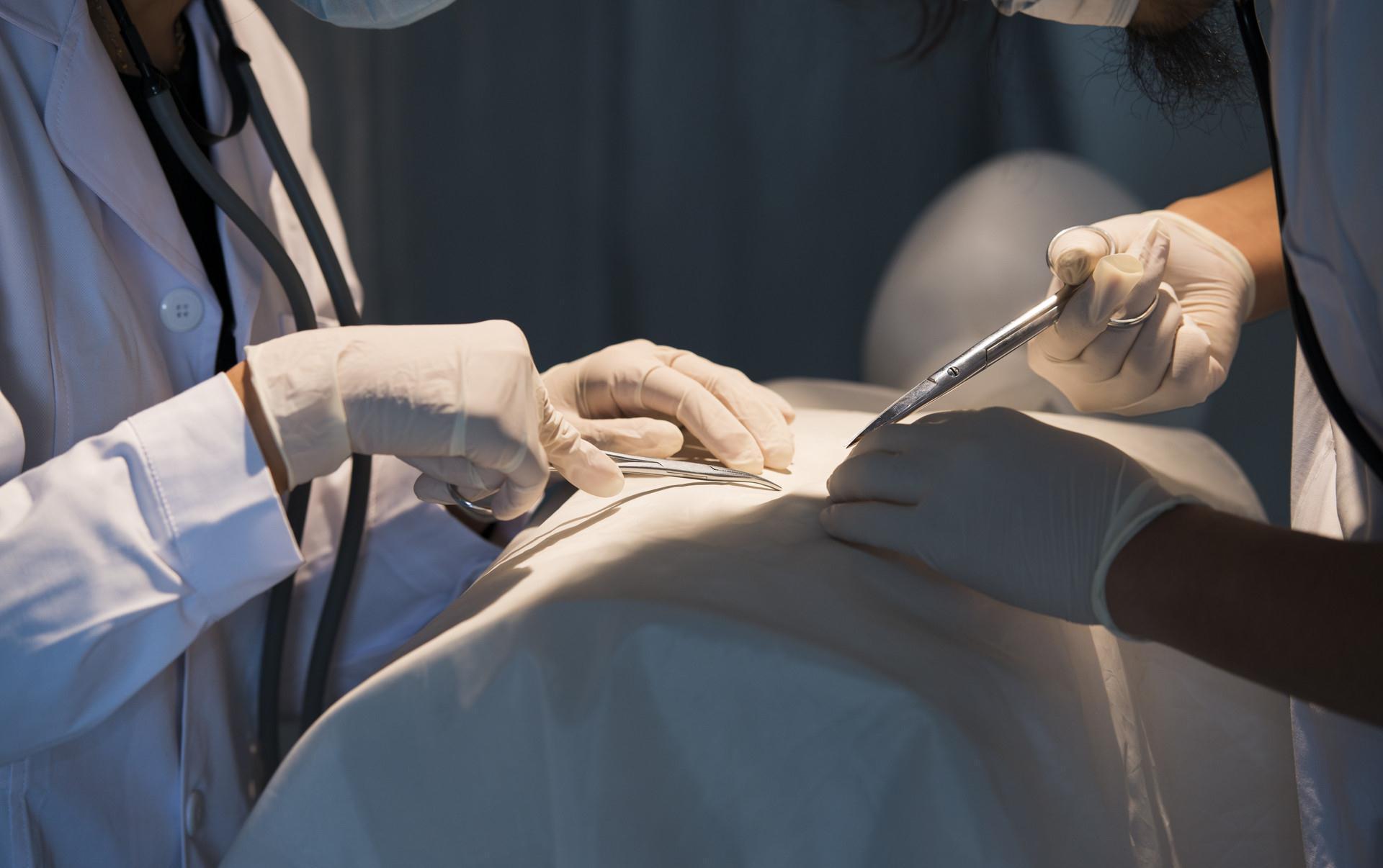 手术|胃癌手术不是一劳永逸,仍有复发风险,术后随访要重视