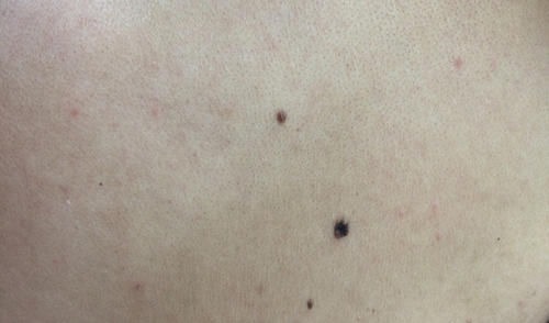 检查|恶性肿瘤到来，身体会发出求救信号，别漠不关心，劝你早做检查