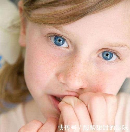 圆圆|5岁女孩喜欢“咬指甲”,宝妈无奈求医,医生太晚了,拔了吧
