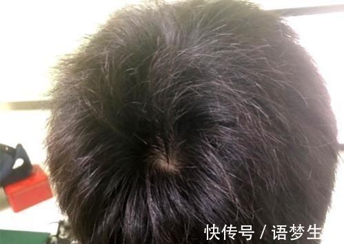 迹象|男人悄悄衰老的5大“迹象”,只要没超过3个,就说明你还比较硬朗