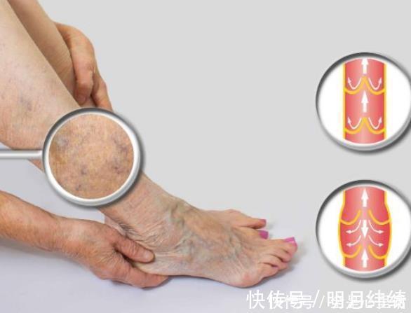 小知识|每天坚持“踮脚”10分钟，4个问题会悄悄远离你，别说没有告诉你