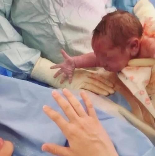 宝宝|“粘人宝宝”火了，一出生就向妈妈索要“抱抱”，医生拦都拦不住