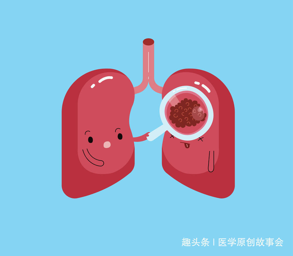 结节|三种结节一旦发现，最好及时切除，一拖再拖会变成恶性肿瘤