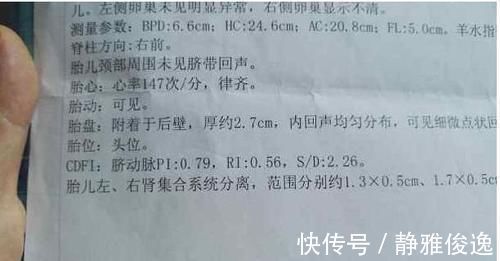 孕妇|产检时,孕妇若发现3个“信号”,或许胎宝的“秘密”藏不住了